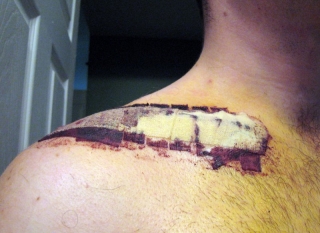 sutures.jpg